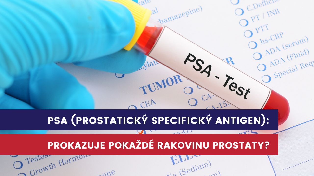 PSA, prostatický specifický antigen